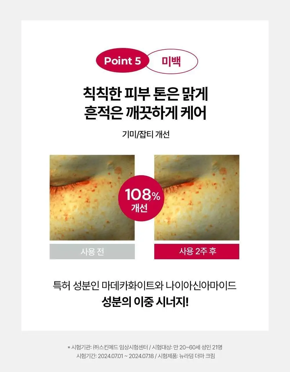 [화잘먹크림] 메디톡스 뉴라덤 더마크림 100g [기획(+20g)/단품] 상세페이지 8